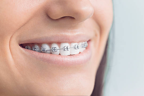 Best Wisdom Tooth Removal  in Geneva, OH